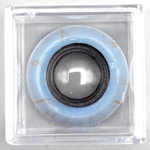 MSICS - MANUAL SMALL INCISION CATARACT SURGERY